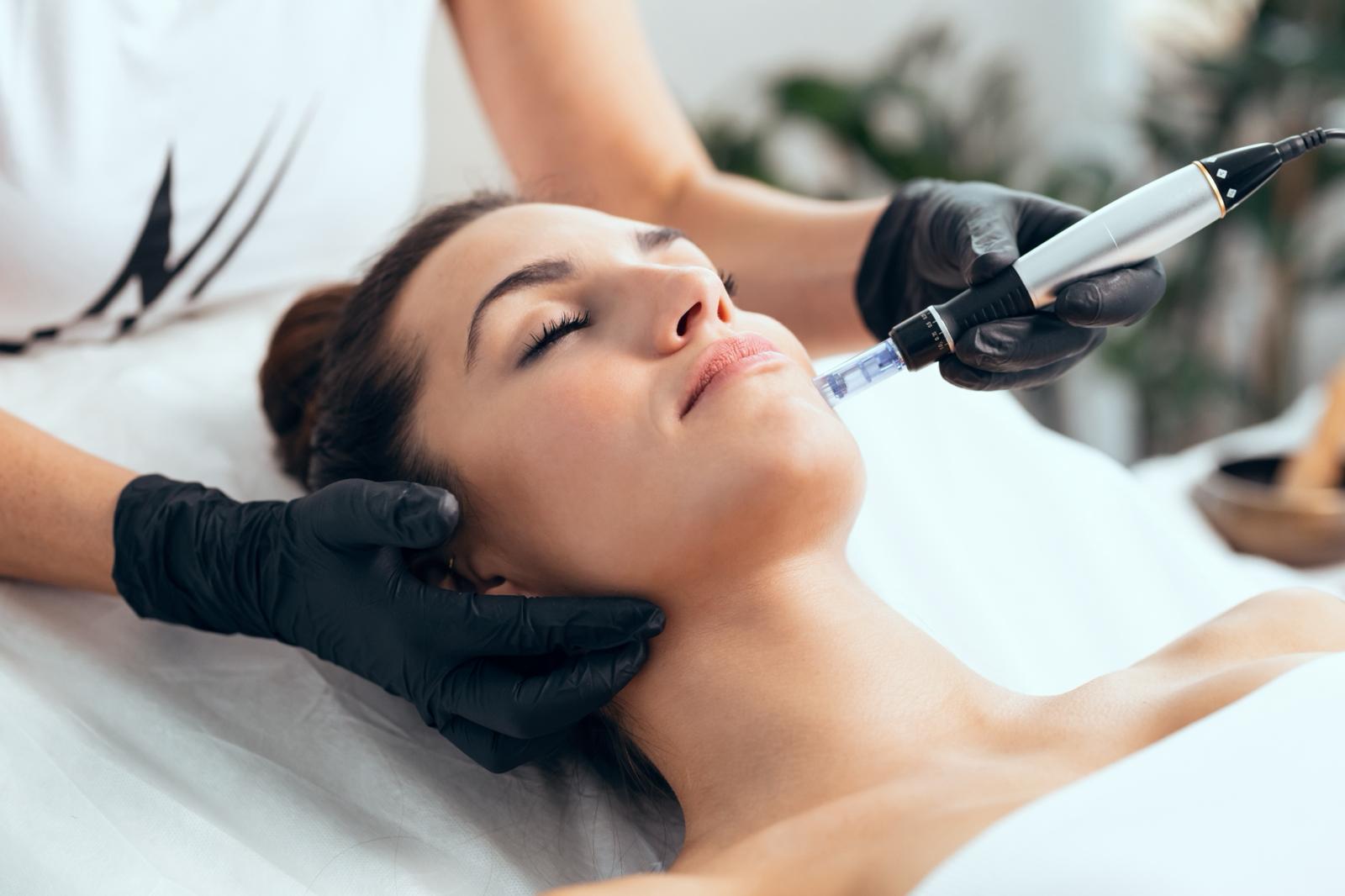 Microneedling Behandlung